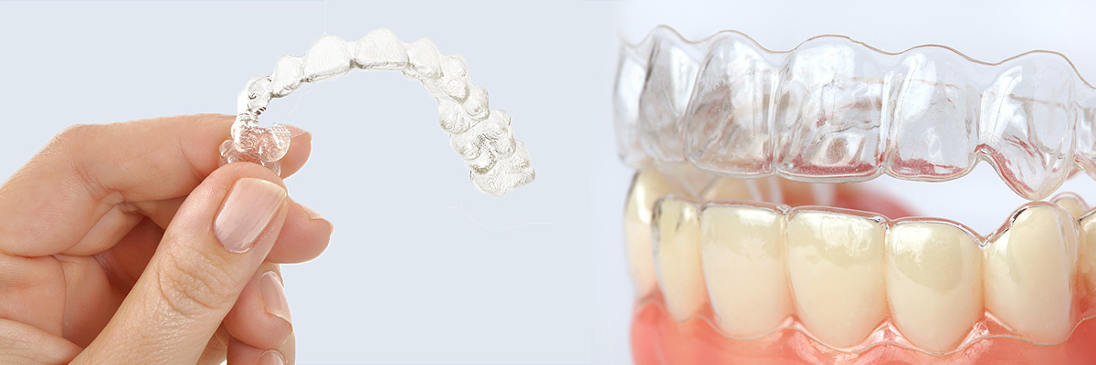 Philadelphia Alternative to Braces for Teens