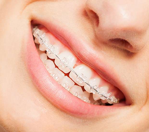 Philadelphia Invisible Orthodontics