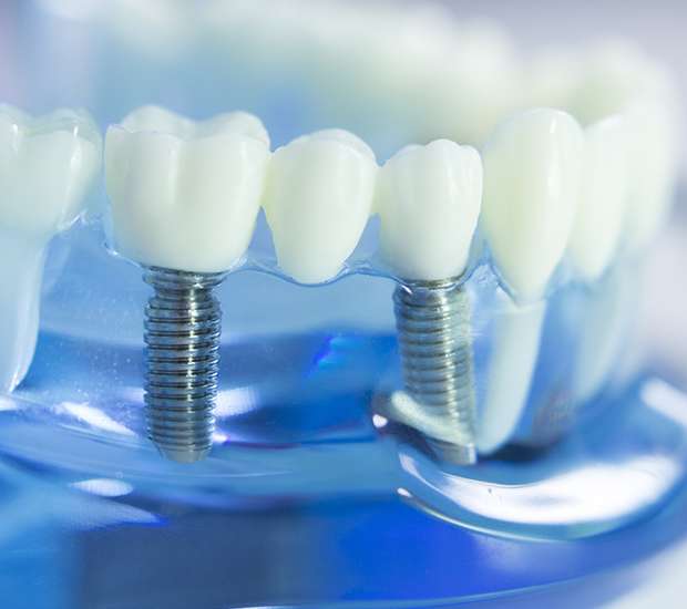 Philadelphia Dental Prosthetics
