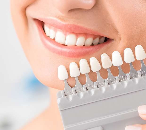 Philadelphia Veneers