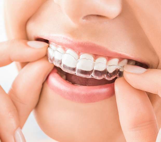 Philadelphia Does Invisalign® Really Work?